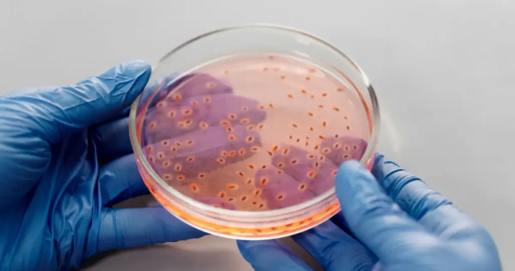 sterilization methods in microbiology