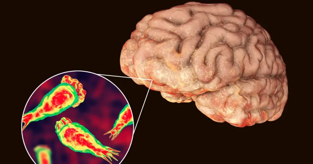 kerala brain eating amoeba