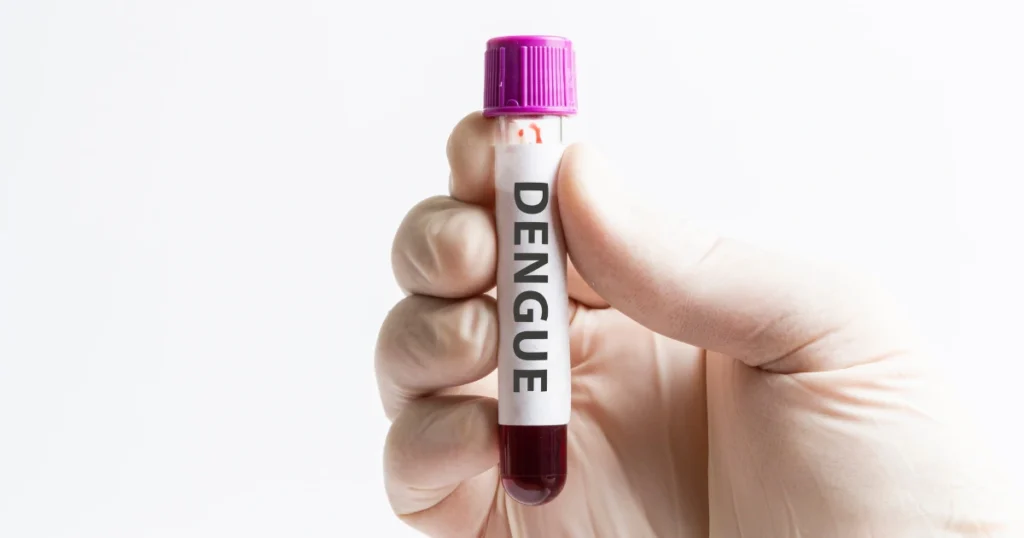 What Are the Symptoms of Dengue Fever: Everything You Need To Know 3 what are the symptoms of dengue fever